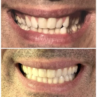 Sorrisi per sito.001