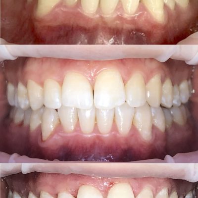 Sorrisi per sito.008